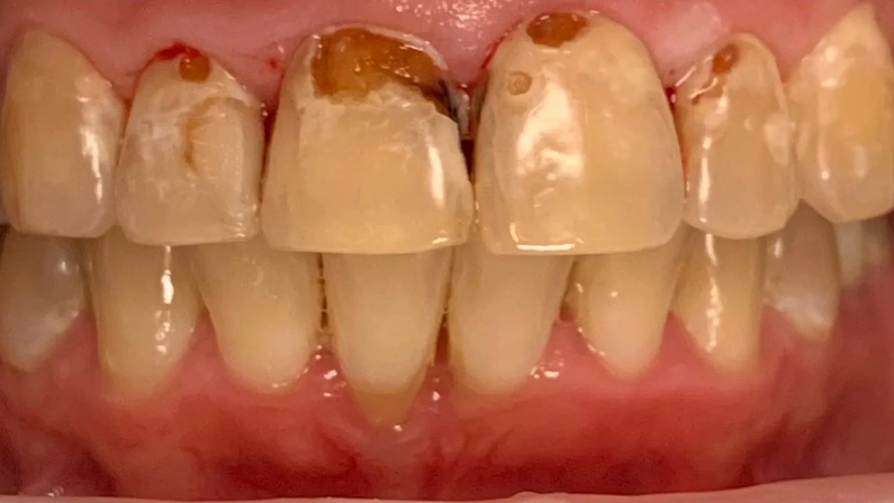 Smile case 3 before treatment