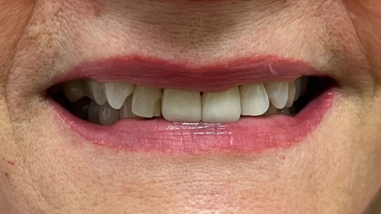 Patient smile before treatment at Rovel Dental